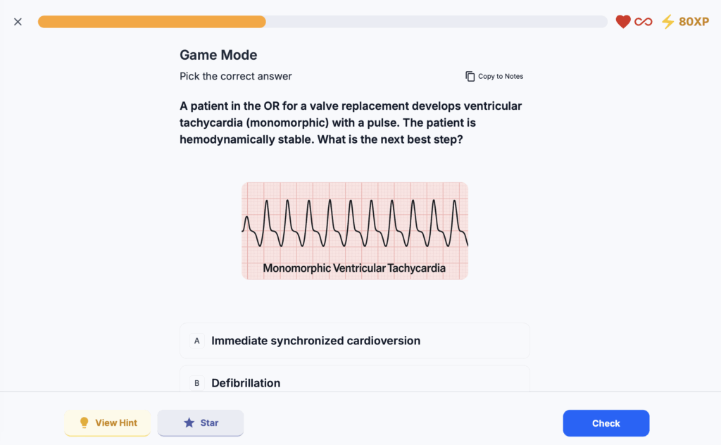 Ollivate Game Mode interface showing a CRNA board prep question on monomorphic ventricular tachycardia with ECG image, answer options, and interactive learning tools.